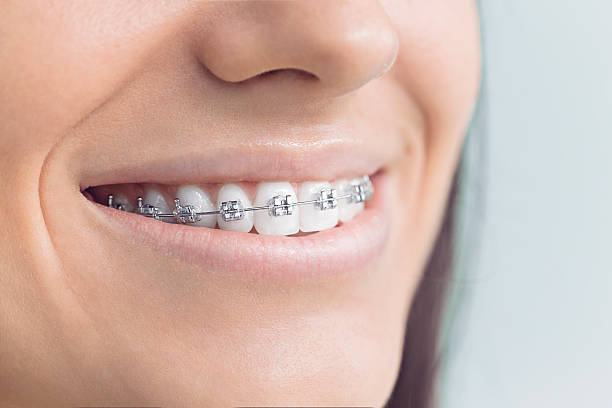 Best Veneers and Lumineers  in Santa Claus, IN